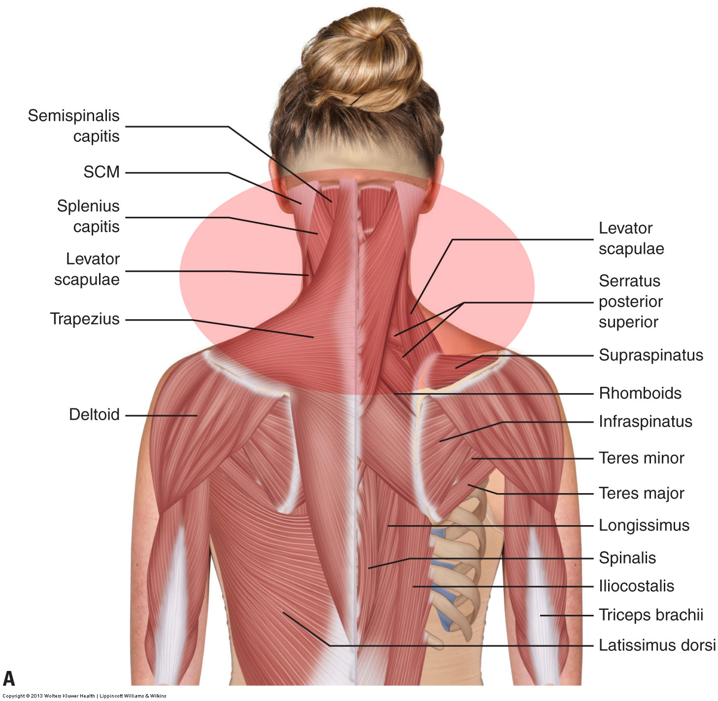 MultiBrief: Simplifying neck assessment for massage therapists
