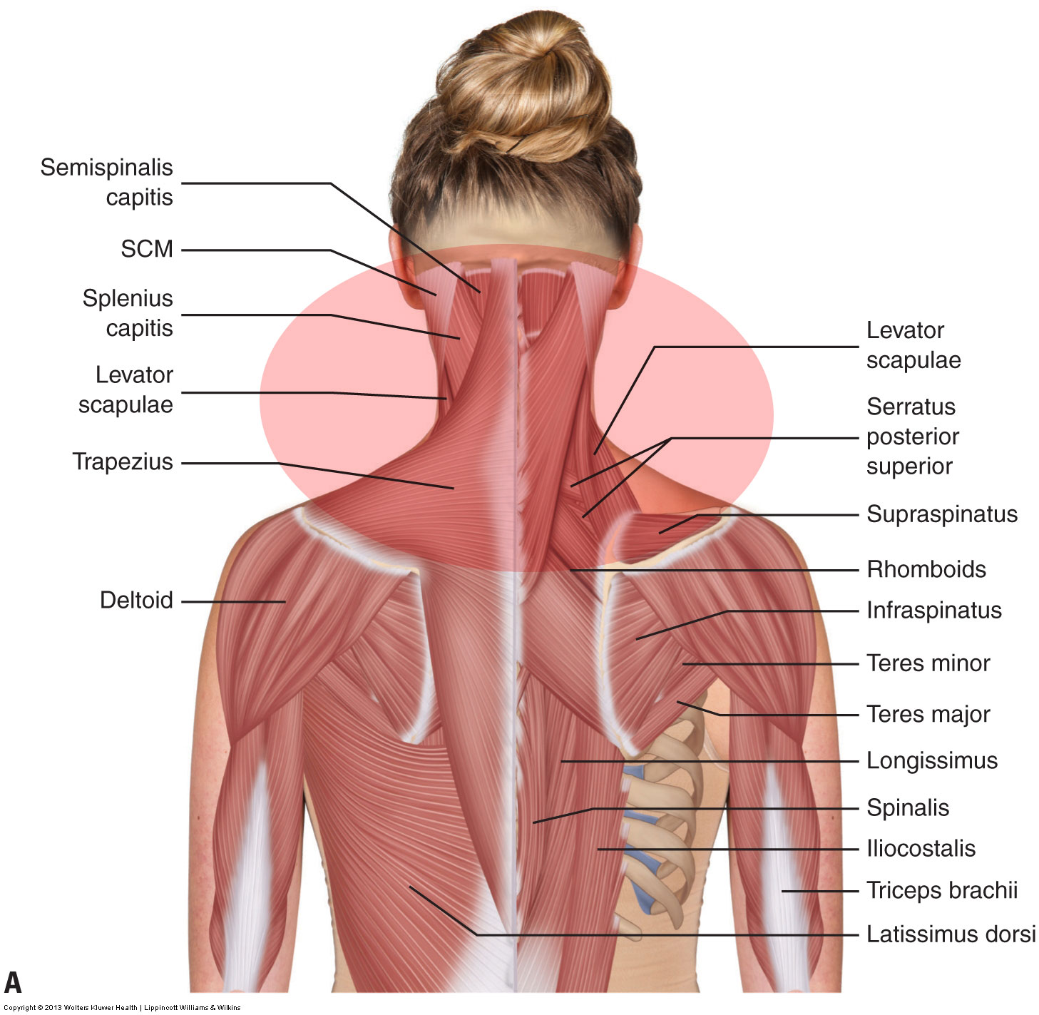 What Are The Causes Of Muscle Spasming In The Neck 