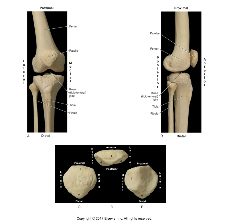 patellofemoral syndrome involves the bones of the patellofemoral joint