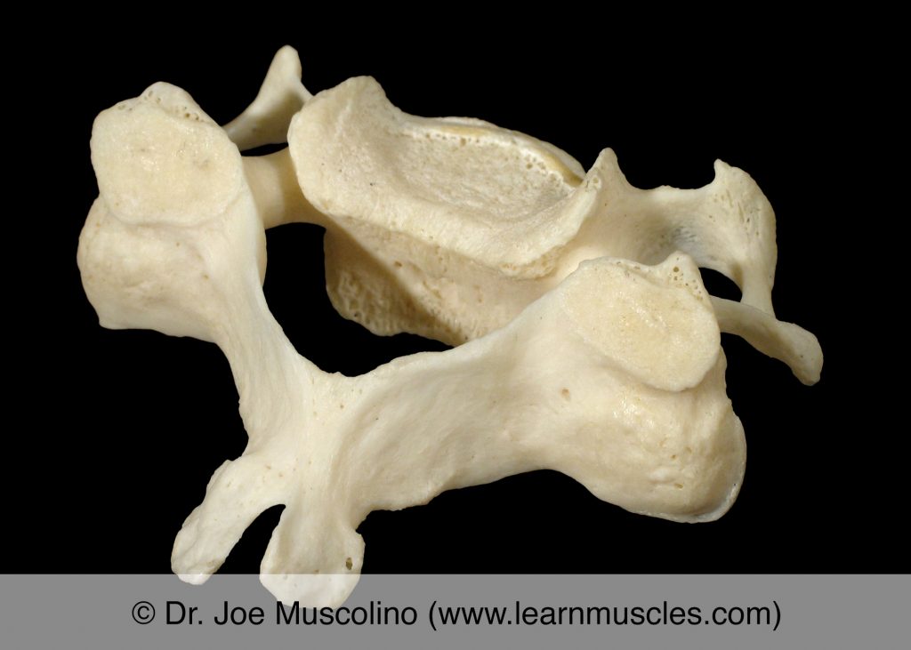 Oblique view (superior posterolateral view) of C5 ("typical cervical vertebra"). 