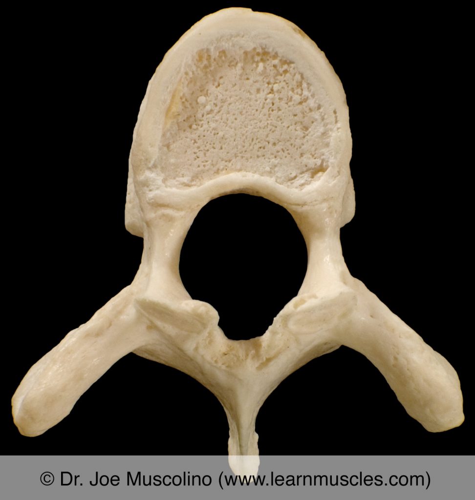 Superior view of T5 ("typical thoracic vertebra").
