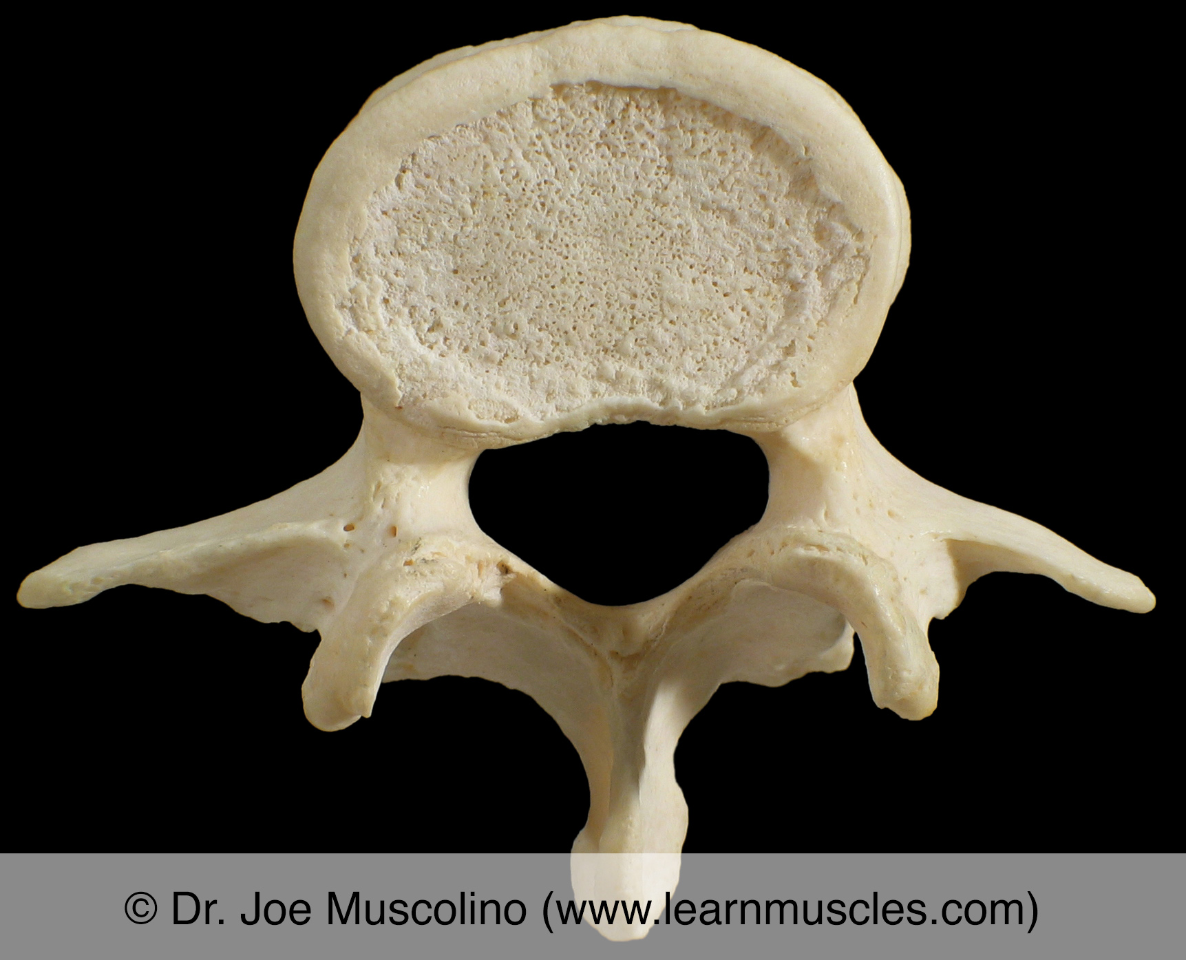 Lumbar Vertebrae - Learn Muscles