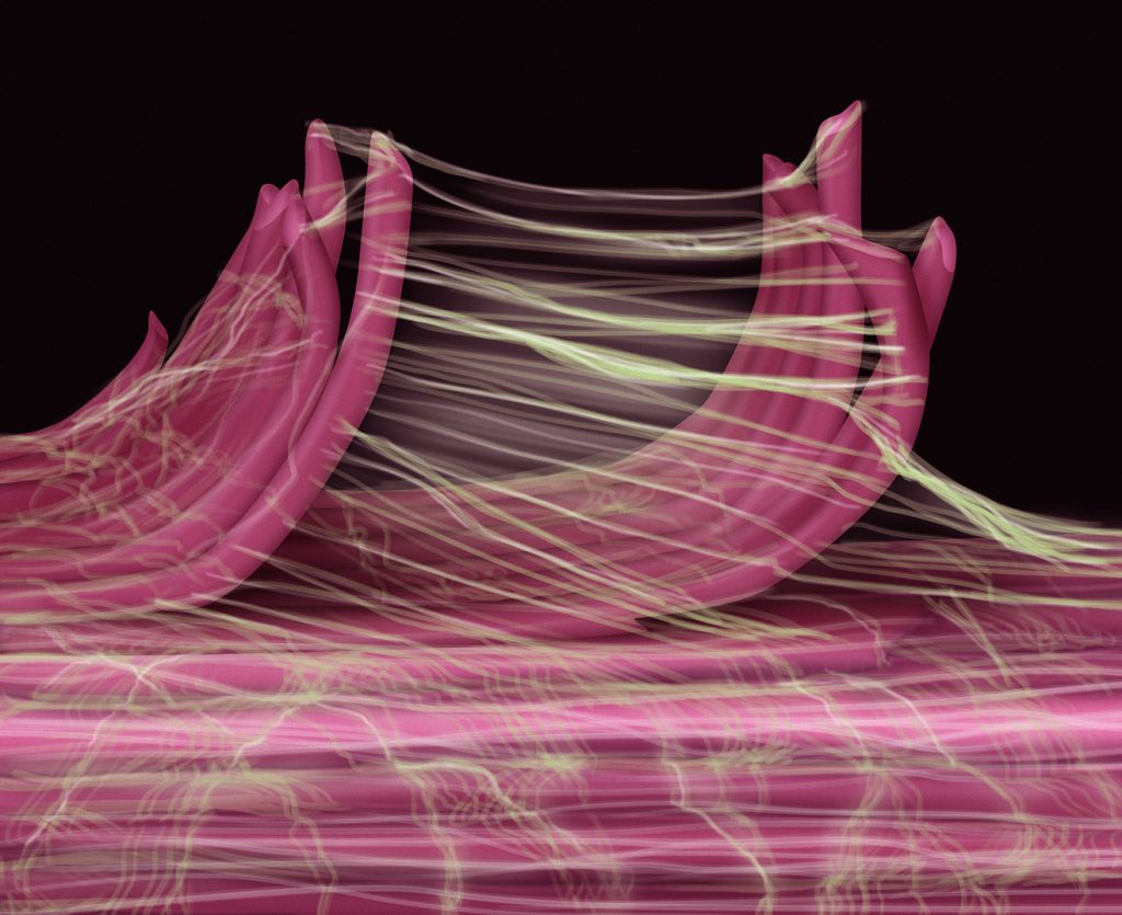 Muscle Scar Tissue Example scar tissue Archives - Learn Muscles