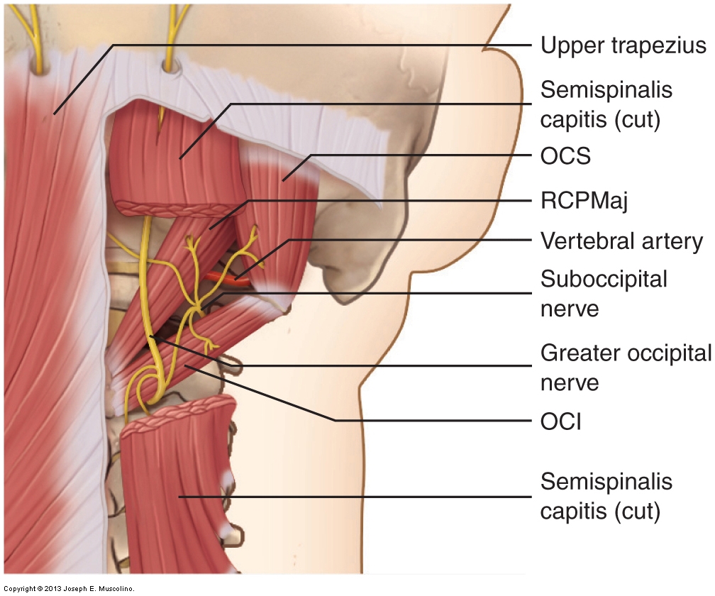 The greater occipital nerve can be compressed by a tight upper trapezius or semispinalis capitis