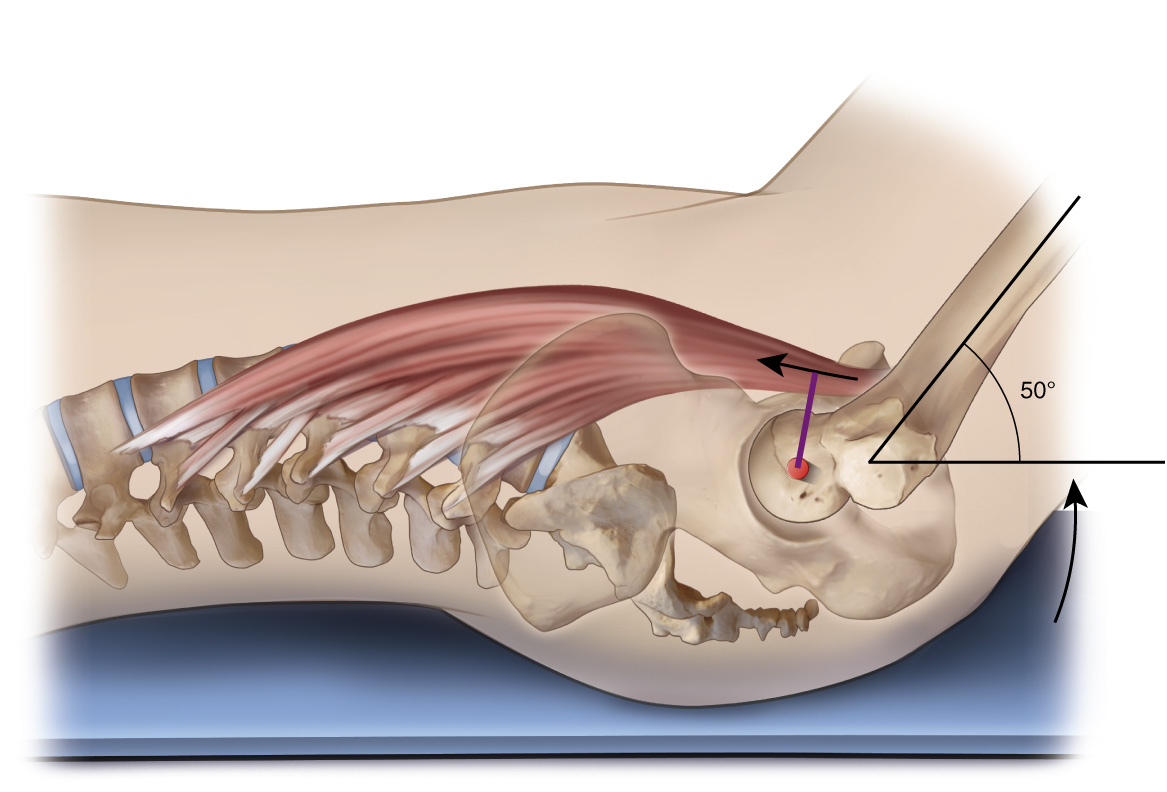 Psoas Major is primarily a flexor of the hip joint