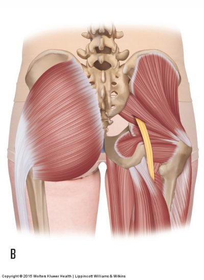 Piriformis Syndrome Entrapment Of The Sciatic Nerve Causing Sciatica