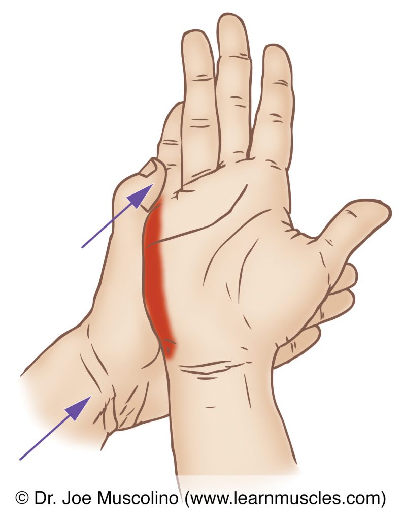 The abductor digiti minimi manus (of the hypothenar eminence group) is stretched with adduction and extension of the little finger at the metacarpophalangeal joint.
