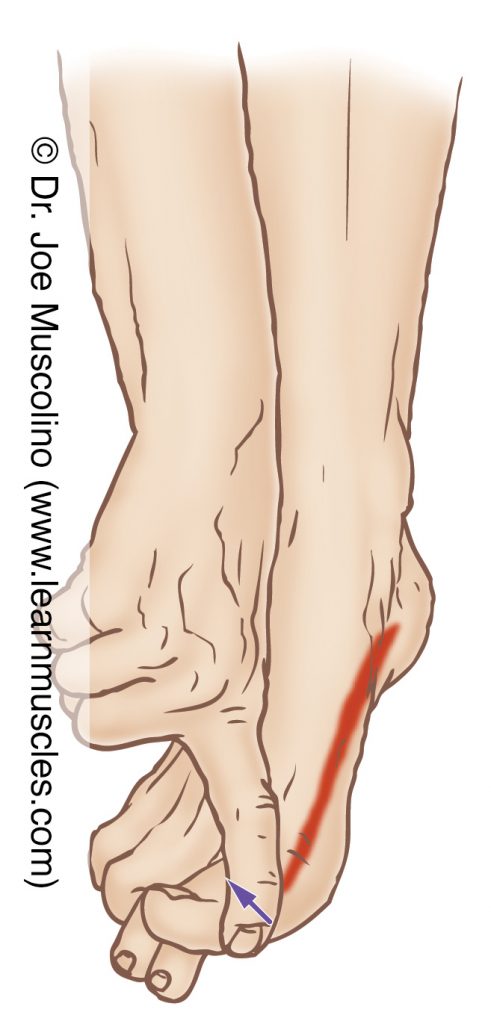 The abductor hallucis (intrinsic muscle of the foot) is stretched by adducting the big toe at the metatarsophalangeal joint.