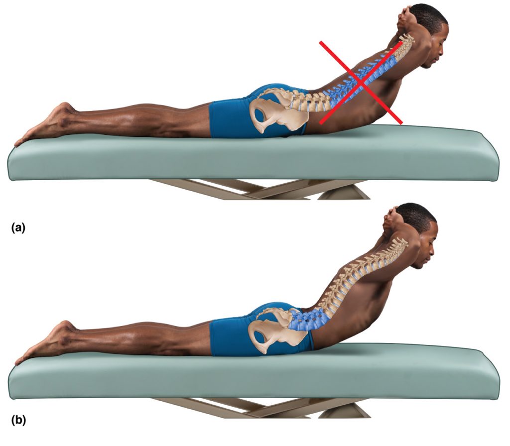 Extension exercise for a hypolordotic lumbar spine.