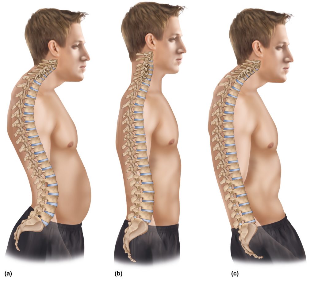 Various spinal curves