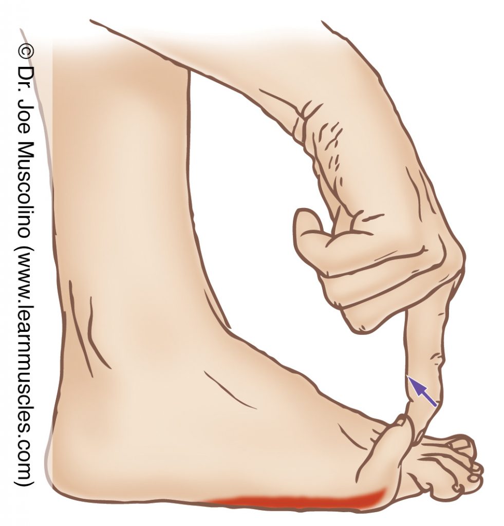 The flexor digiti minimi pedis (intrinsic muscle of the foot) is stretched by extending the little toe at the metatarsophalangeal joint.