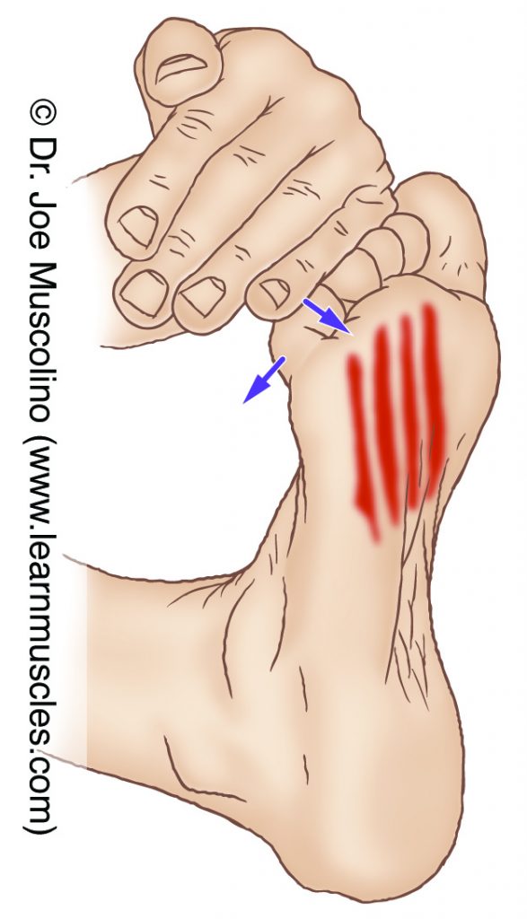 The flexor digitorum brevis (intrinsic muscle of the foot) is stretched by extending toes #2-5 at the metatarsophalangeal and proximal interphalangeal joints.
