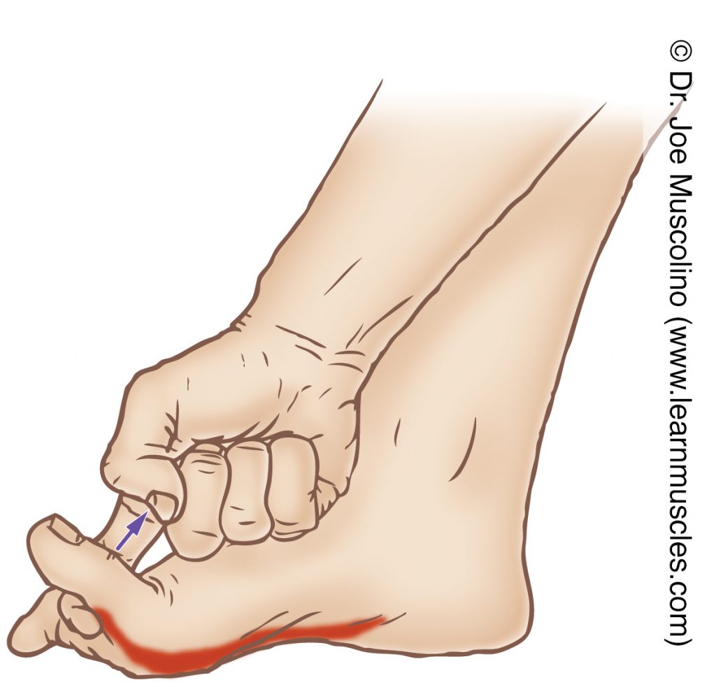 The flexor hallucis brevis (intrinsic muscle of the foot) is stretched by extending the big toe at the metatarsophalangeal joint.