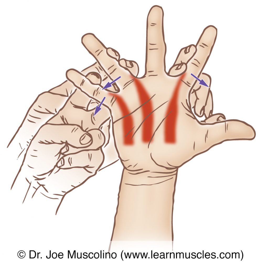 The palmar interossei (of the central compartment group) are stretched with abduction of the index, ring, and little fingers at the metacarpophalangeal joints.