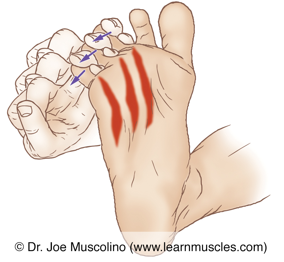 The plantar interossei (intrinsic musculature of the foot) are stretched by abducting toes #3-5 at the metatarsophalangeal joints.