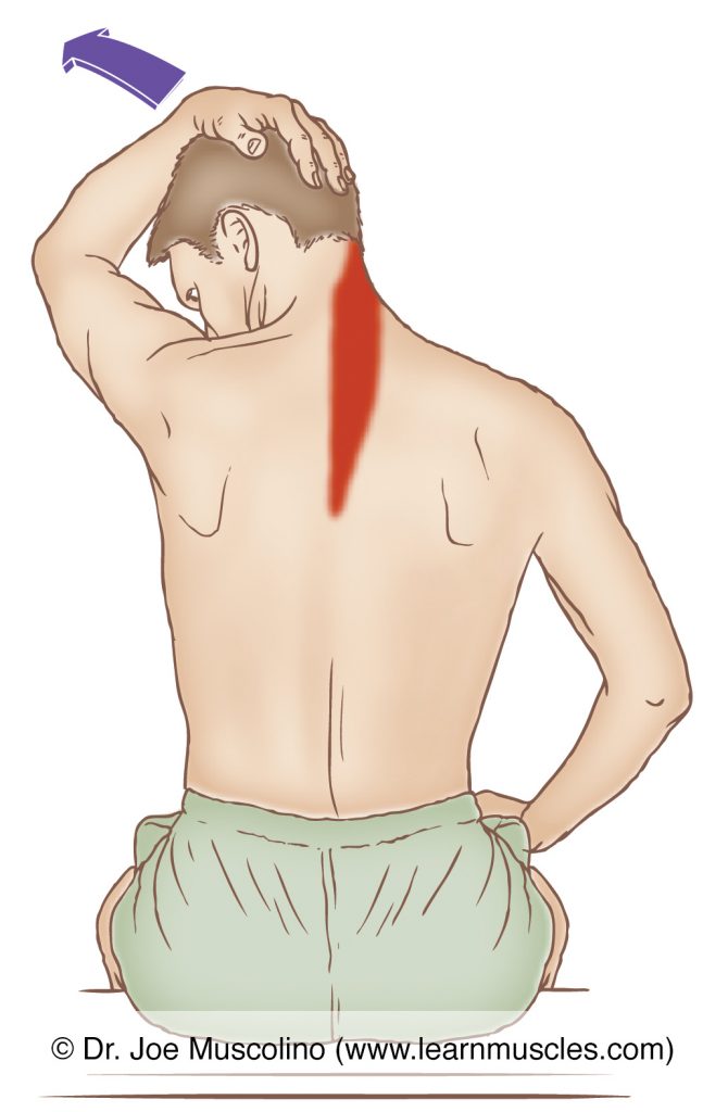 The right-side splenius capitis is stretched by flexing, left laterally flexing, and left rotating the head and neck at the spinal joints, while the right-side shoulder girdle is allowed to elevate. 