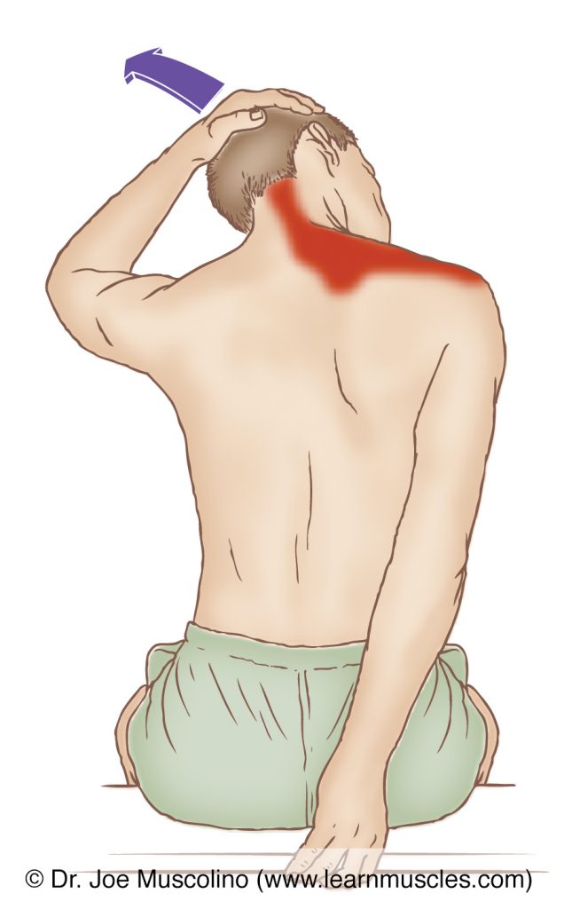 The right-side upper trapezius is stretched with flexion, left lateral flexion, and right rotation of the head and neck at the spinal joints. Note that the right shoulder girdle is stabilized downward.