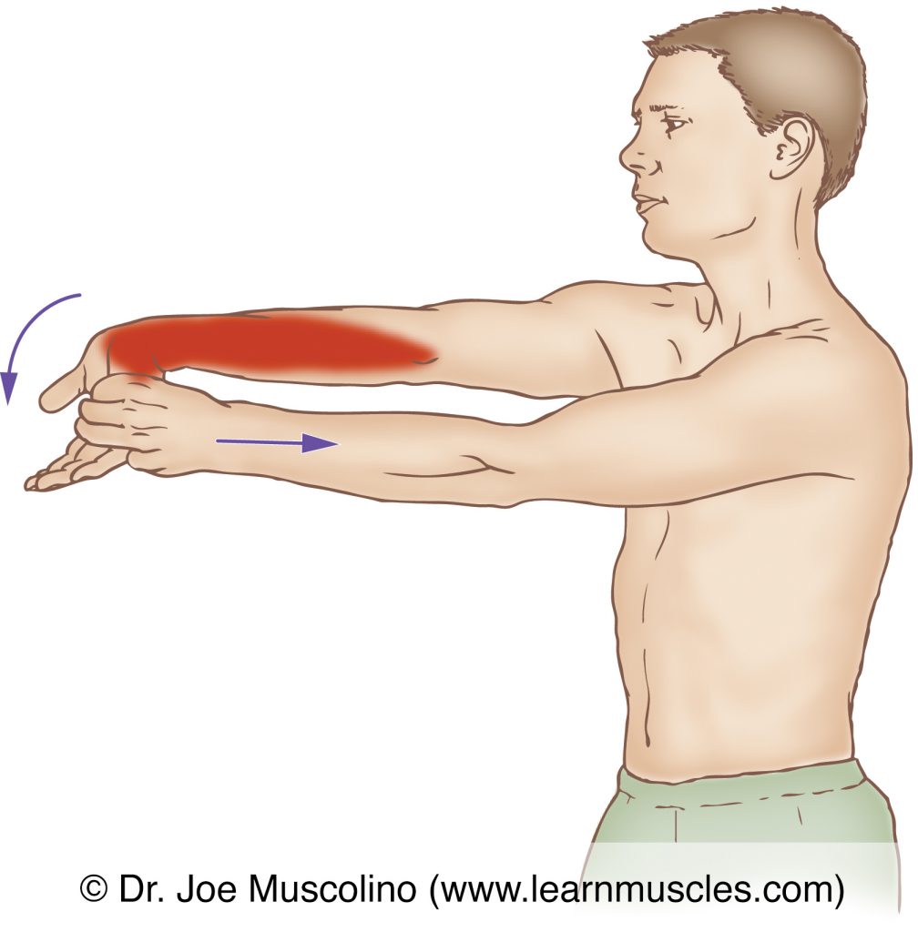 The flexor carpi ulnaris (of the wrist flexor group) is stretched with extension and radial deviation of the hand at the wrist joint, and the elbow joint fully extended.
