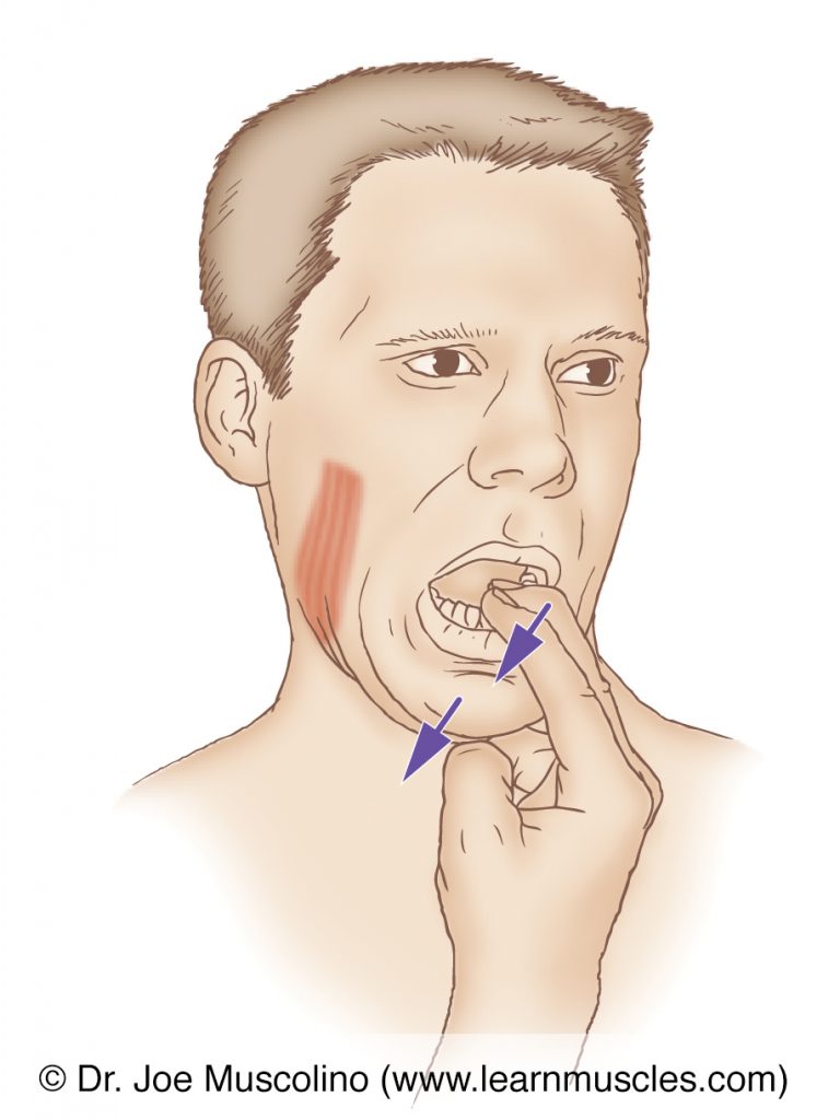 The right medial pterygoid muscle, a muscle of mastication, is stretched by depressing and ipsilaterally deviating (deviating to the same side) the mandible at the temporomandibular joints (TMJs).