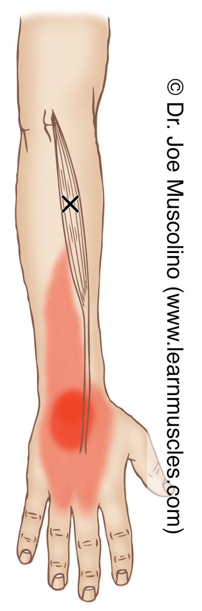 Extensor Carpi Radialis Brevis - Trigger Points - Learn Muscles