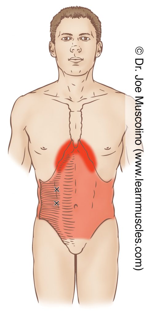 Anterior view of myofascial trigger points in the right-side transversus abdominis and their corresponding referral zones.