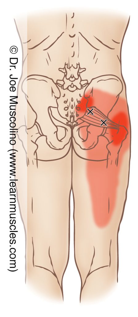 Piriformis Trigger Points
