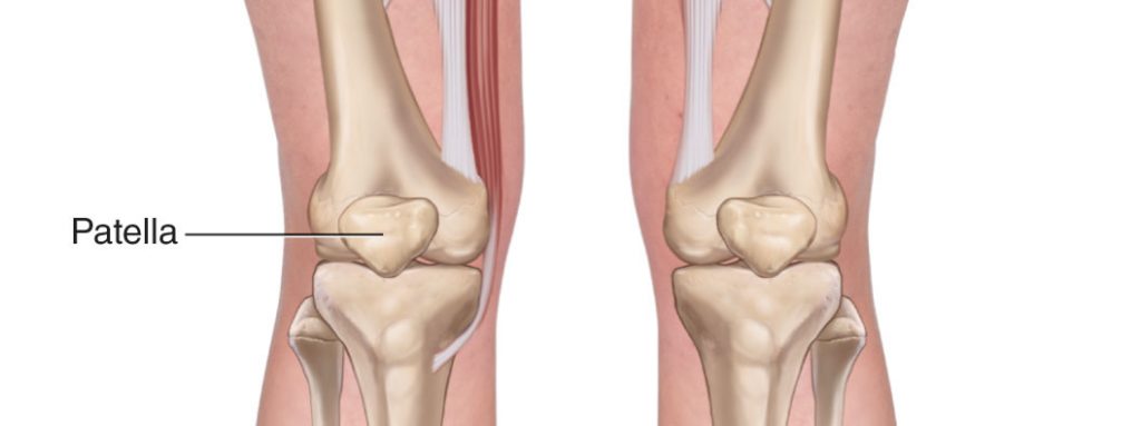 Anterior view of the knee joint bilaterally. Permission Joseph E.Muscolino. www.learnmuscles.com.