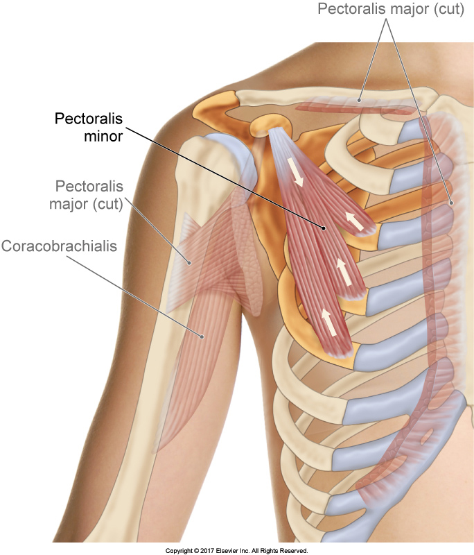 The Pectoralis Minor. Permission Joseph E. Muscolino. The Muscular System Manual - The Skeletal Muscles of the Human Body, 4th ed. (Elsevier, 2017).