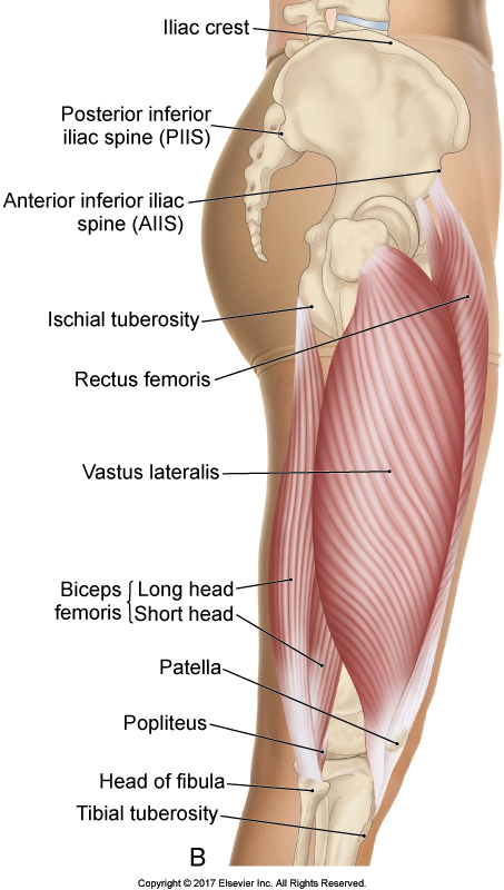 Lateral thigh: vastus laterals deep to the ITB