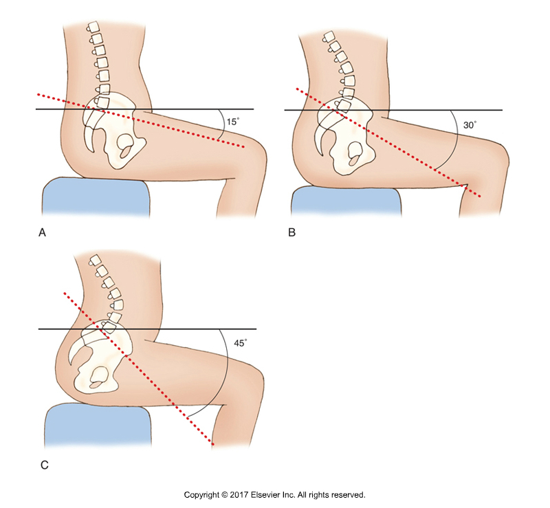 Spinal Posture. Permission Dr. Joe Muscolino. 
