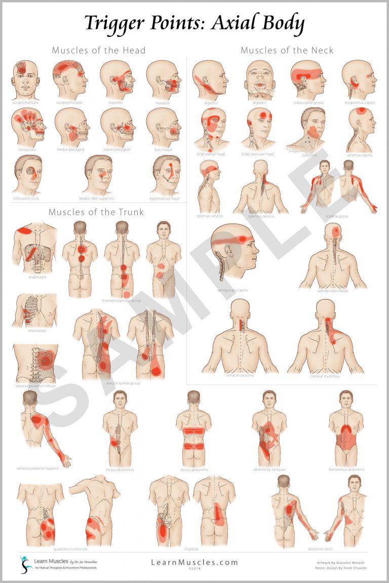 Trigger Point Boss Trigger Point - COMPLETE SET 24