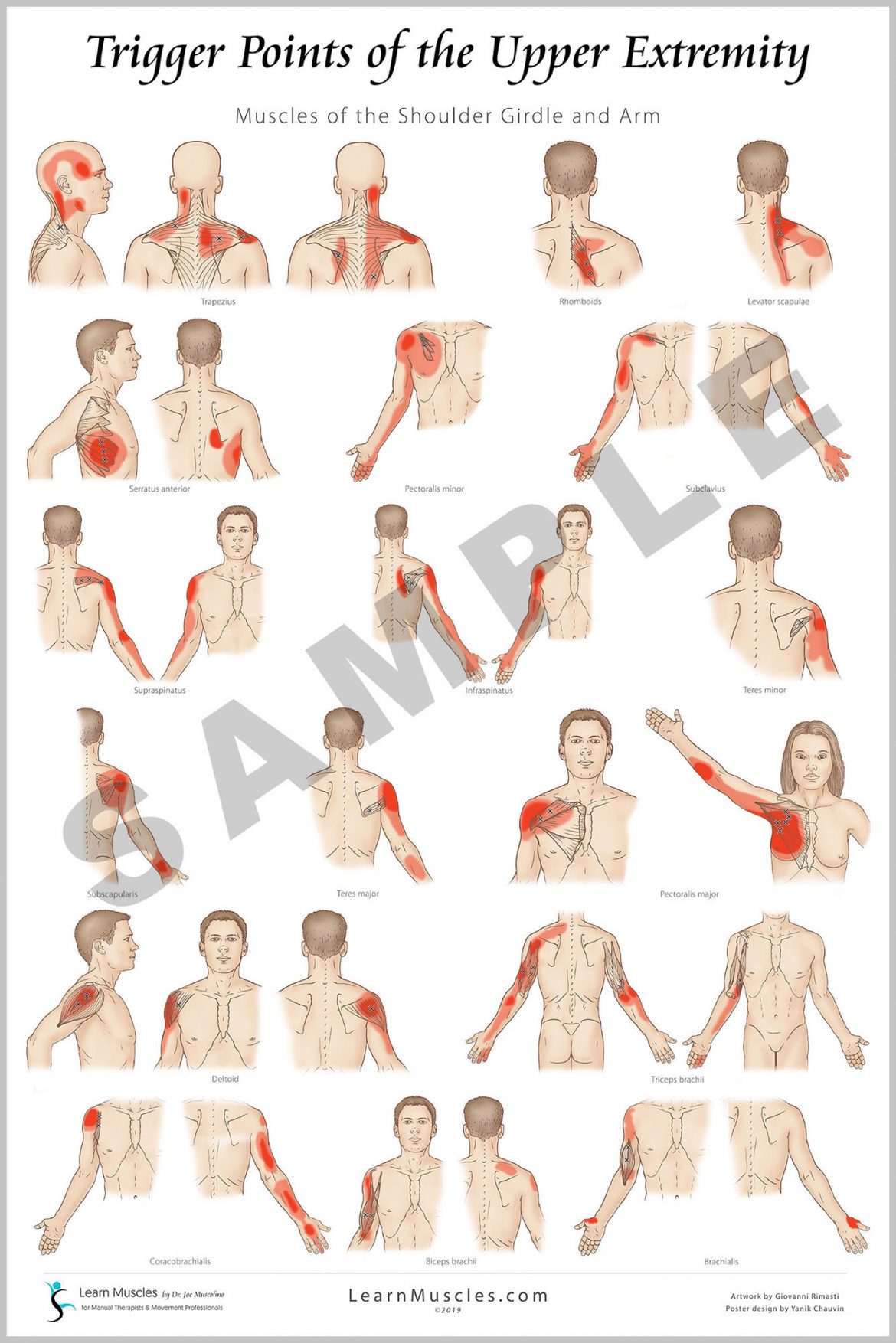 Trigger Point Upper Extremity 24 X 36 Premium Poster 2 Pack Learn Muscles