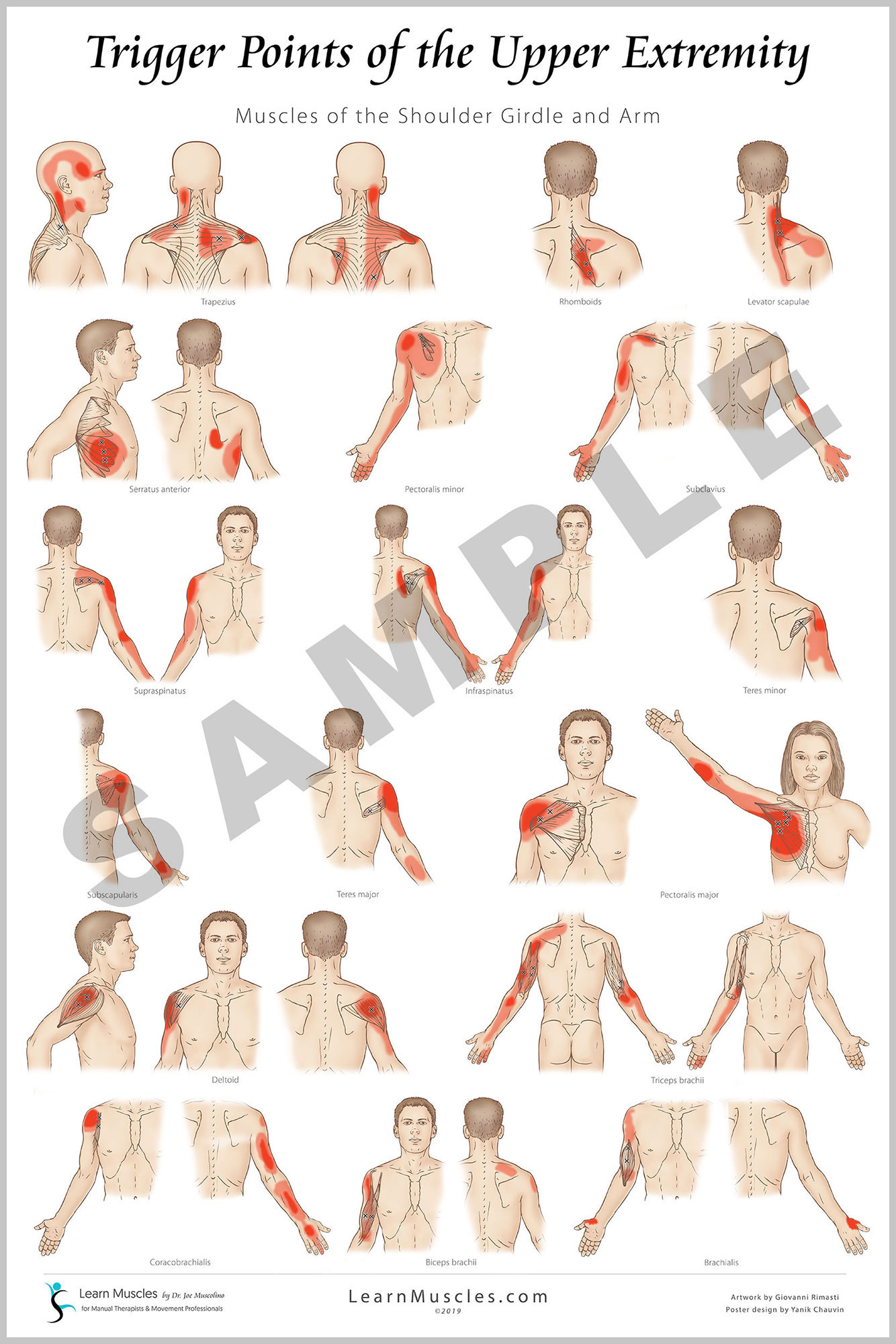 Trigger Point Upper Extremity 24" x 36" Premium Poster 2 Pack Learn