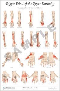 Trigger Point COMPLETE SET 24 X 36 Premium Poster Learn Muscles trigger-point-complete-set-24-x-36-premium-poster-learn-muscles