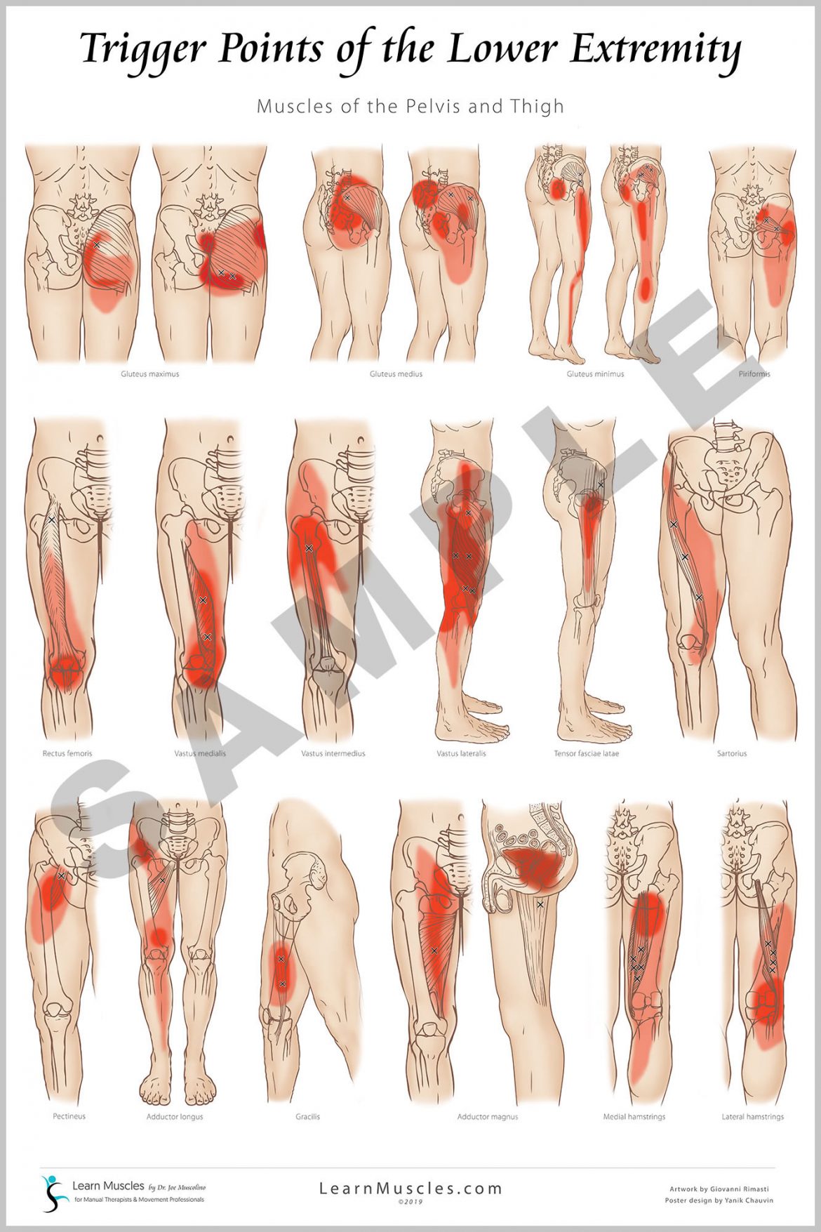 Trigger Point Lower Extremity 24 X 36 Premium Poster 2 Pack Pre Order Learn Muscles
