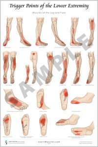 Trigger Point COMPLETE SET 24 X 36 Premium Poster Learn Muscles trigger-point-complete-set-24-x-36-premium-poster-learn-muscles