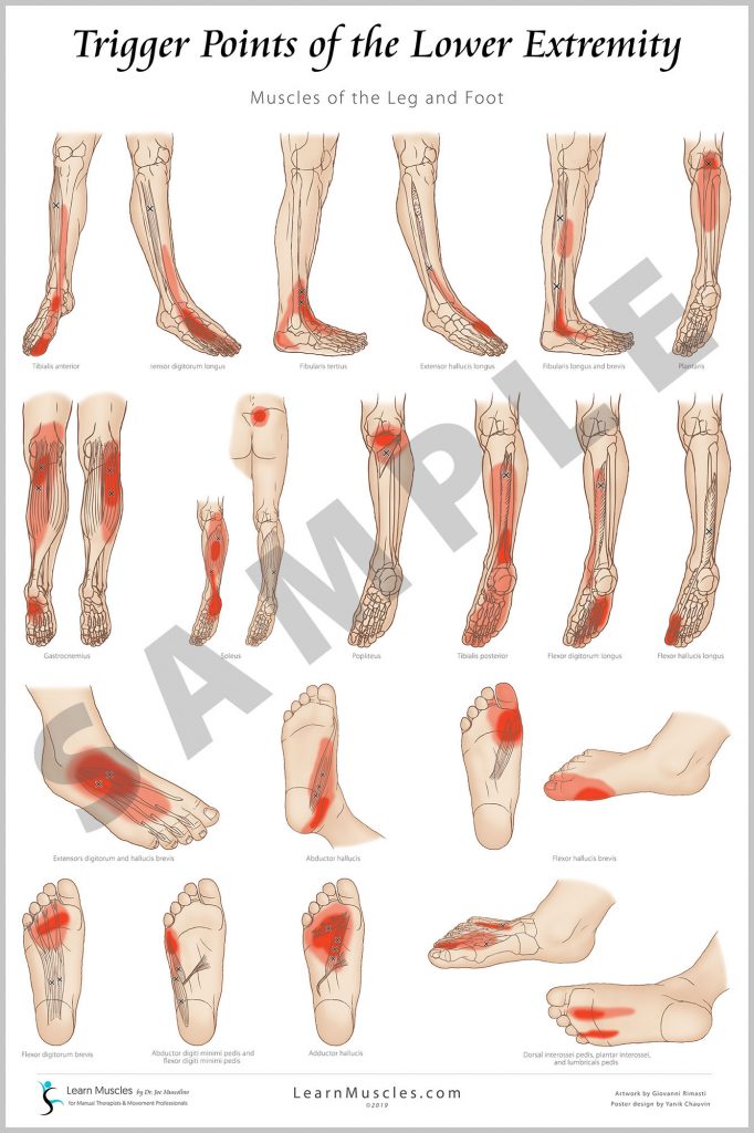 Trigger Point Lower Extremity 24" x 36" Premium Poster 2 Pack (PRE