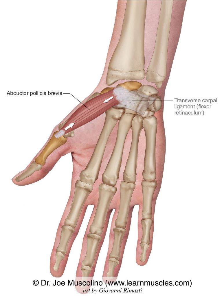 The abductor pollicis brevis of the intrinsic muscles of the hand. The transverse carpal ligament (flexor retinaculum) has been drawn in.