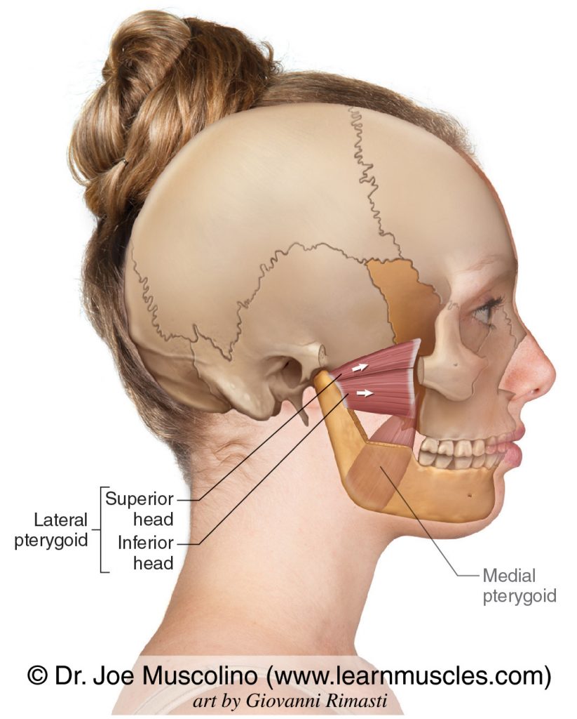 The lateral pterygoid on the right side of the body. We seen the superior and inferior heads. The medial pterygoid has been ghosted in. And note that part of the mandible has been cut away. 