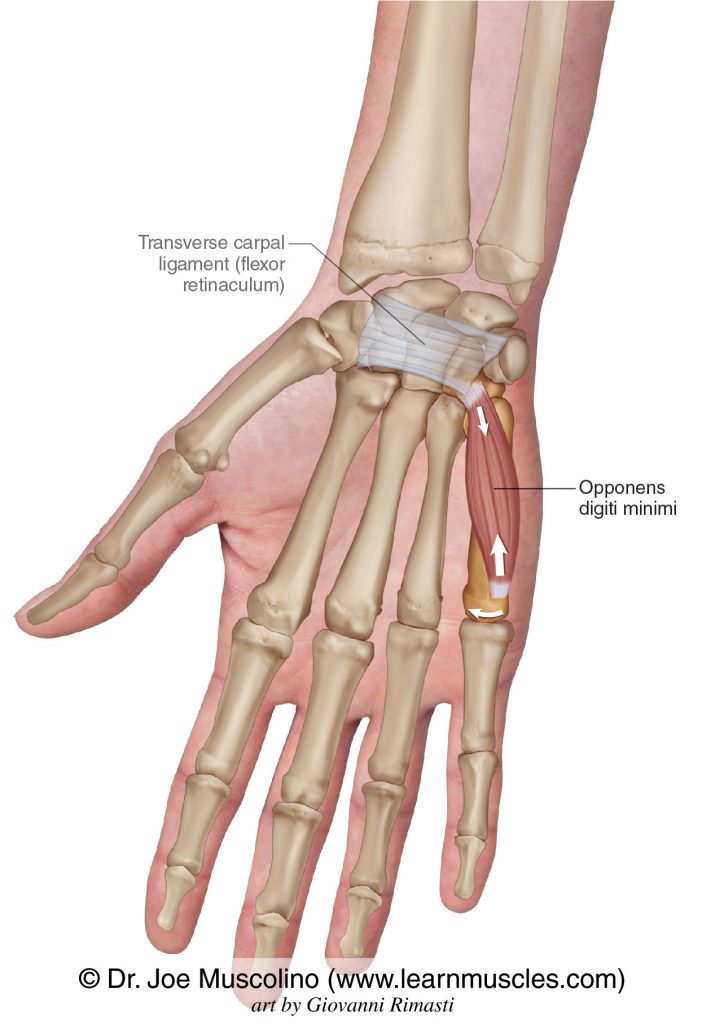 The opponens digiti minimi intrinsic muscle of the hand. The transverse carpal ligament (flexor retinaculum) has been drawn in.