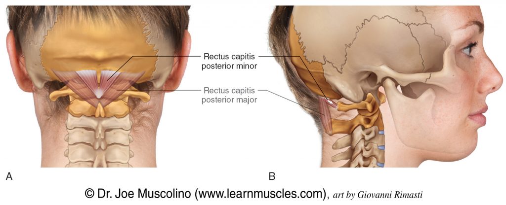 Posterior and right-lateral views of the rectus capitis posterior minor of the suboccipital group. The rectus capitis posterior major has been ghosted into both views.