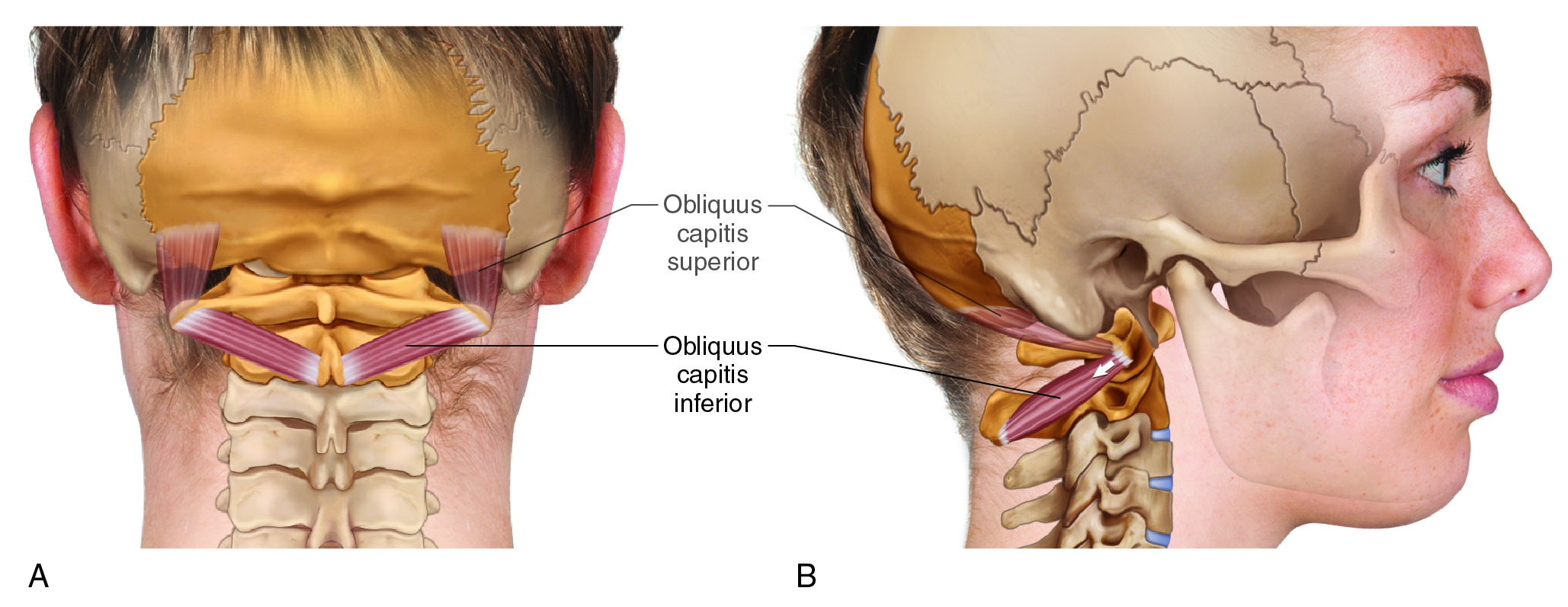 Obliquus Capitis Inferior - A Misnamed Muscle